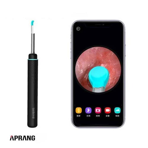 گوش پاک کن هوشمند شیائومی مدل Bebird M9 Pro(لطفا با هماهنگی خرید بفرمایید)