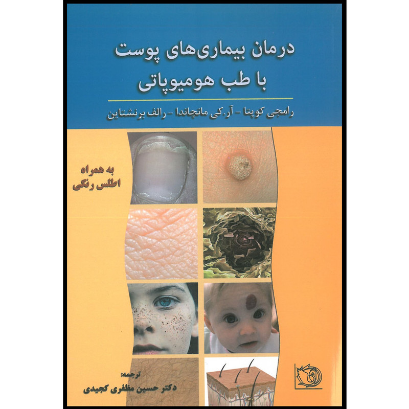 کتاب درمان بیماری های پوست با هومیوپاتی اثر رامجی گوپتا انتشارات اشراقیه