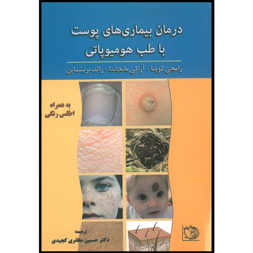 کتاب درمان بیماری های پوست با هومیوپاتی اثر رامجی گوپتا انتشارات اشراقیه